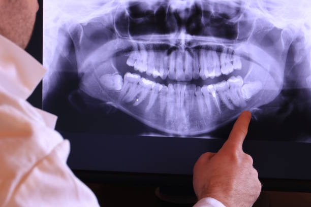 Best Dentist for Tooth Abscess  in Garland, NC