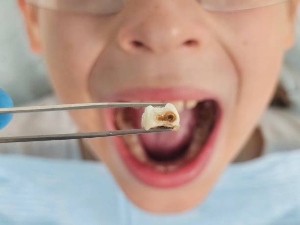 Best Cracked Tooth Emergency Dentist  in Garland, NC